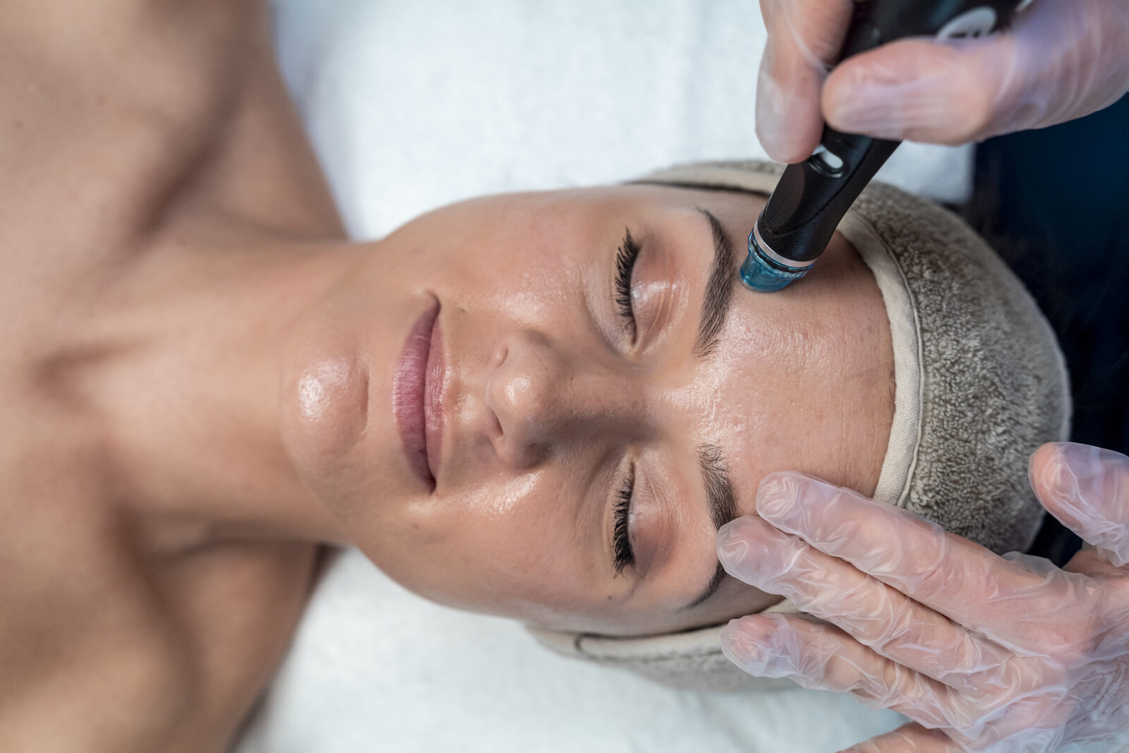 Hydrafacial hydra-dermabrasion treatment being applied to the forehead